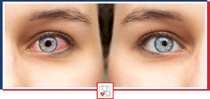Pink Eye Treatment Clinic in Boca Raton, FL Pink Eye Treatment Clinic in Boca Raton, FL