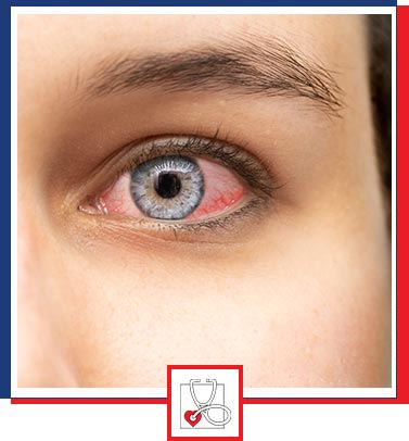 Pink Eye Treatment Near Me in Boca Raton, FL