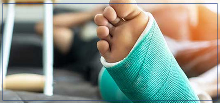 Broken Bones and Fractures Treatment Clinic Near Me in Boca Raton, FL